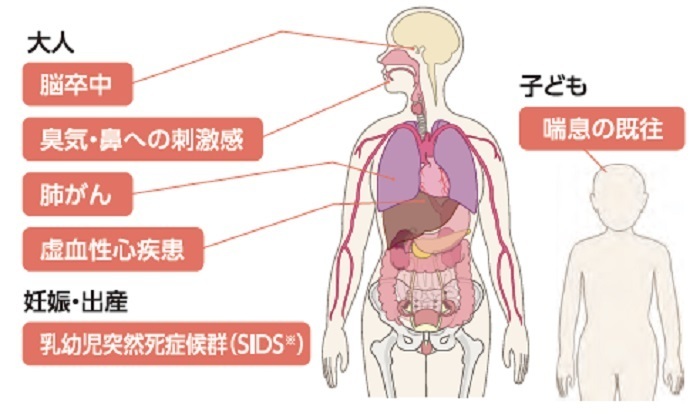 受動喫煙が関連する疾患