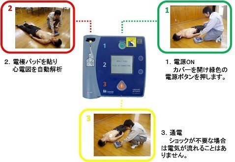 AEDの操作手順